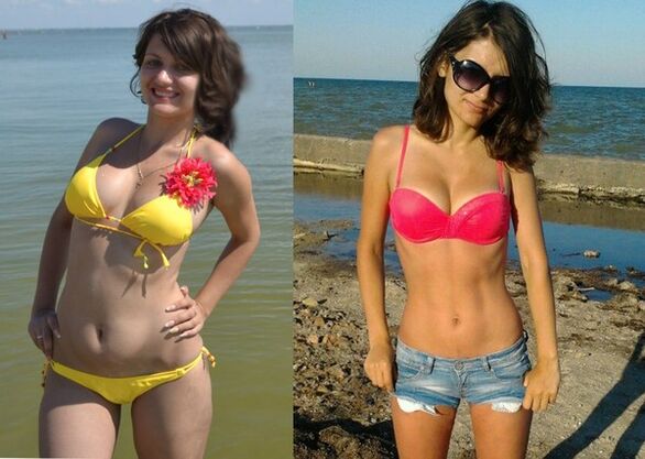 Anna hat mit NexaSlim 10 kg abgenommen